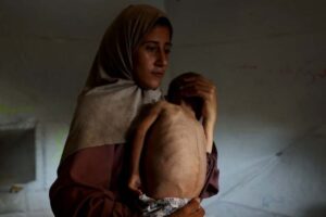 gaza famine humanitarian crisis