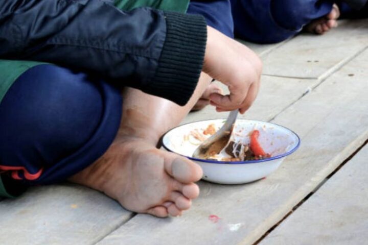 malnutrition