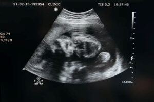 artificial wombs and assisted reproduction