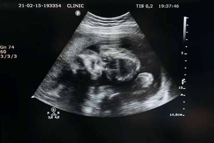 artificial wombs and assisted reproduction