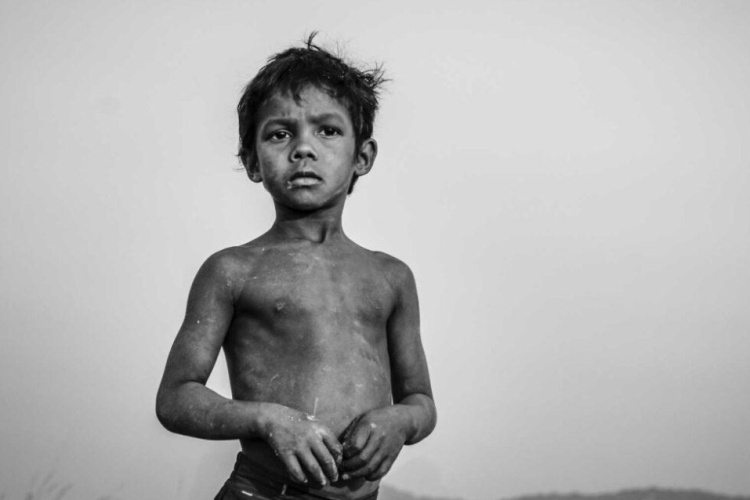diarrhoea and India’s child malnutrition crisis