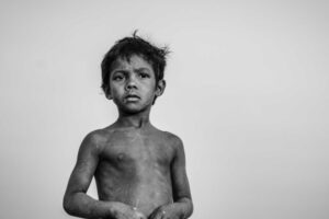 Malnutrition policy
