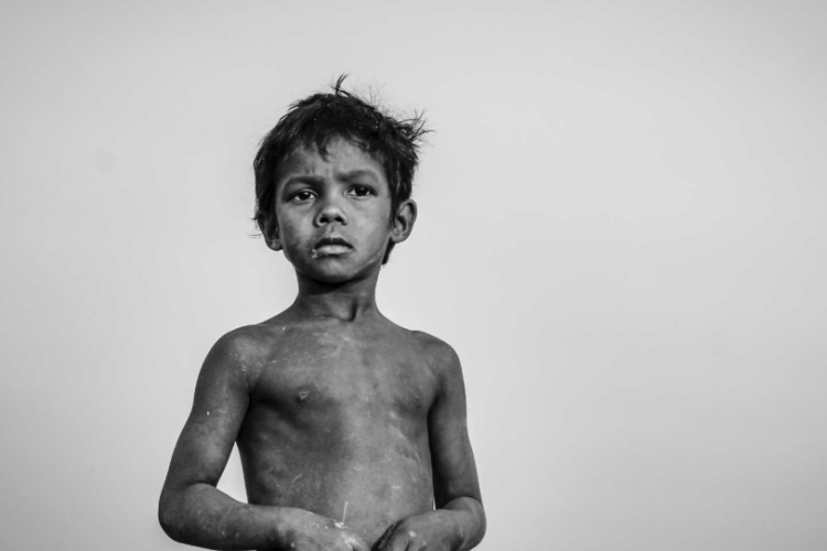 Malnutrition policy