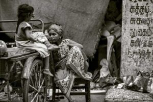 malnutrition